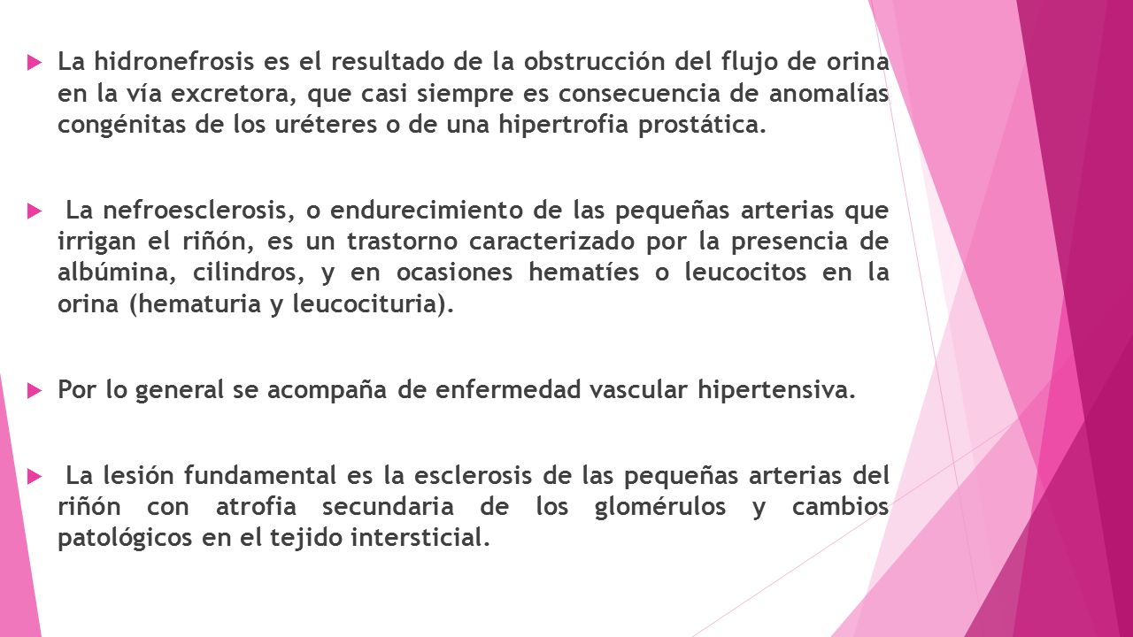 La hidronefrosis es el resultado de la obstrucción del flujo de orina en la vía excretora, que casi siempre es consecuencia de anomalías congénitas de los uréteres o de una hipertrofia prostática.
