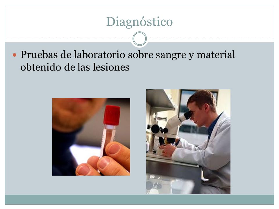 Diagnóstico Pruebas de laboratorio sobre sangre y material obtenido de las lesiones