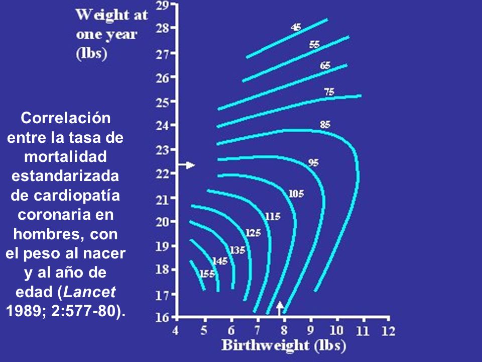 Correlación entre la tasa de mortalidad estandarizada de cardiopatía coronaria en hombres, con el peso al nacer y al año de edad (Lancet 1989; 2:577-80).