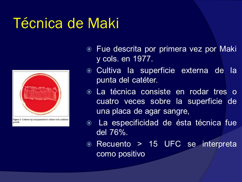 Técnica de Maki Fue descrita por primera vez por Maki y cols. en 1977.