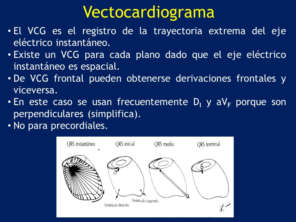 Vectocardiograma El VCG es el registro de la trayectoria extrema del eje eléctrico instantáneo.