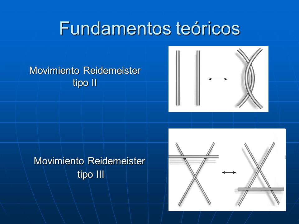 Fundamentos teóricos Movimiento Reidemeister tipo II