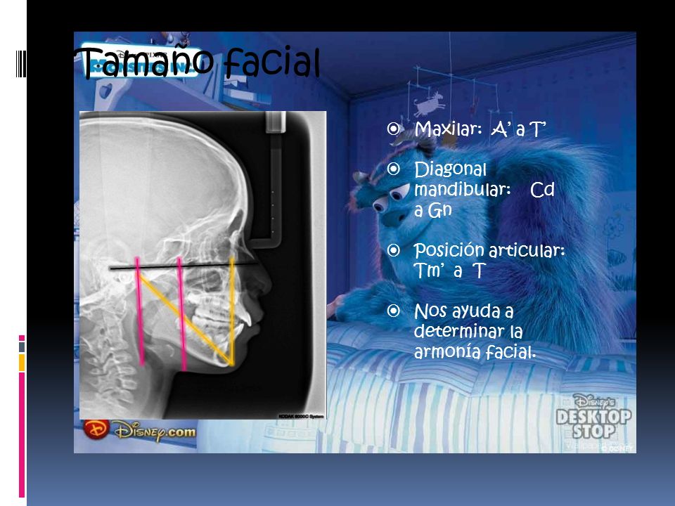 Tamaño facial Maxilar: A’ a T’ Diagonal mandibular: Cd a Gn