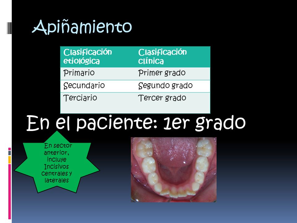 En sector anterior, incluye Incisivos centrales y laterales