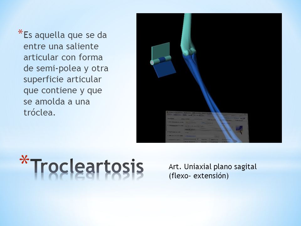 Es aquella que se da entre una saliente articular con forma de semi-polea y otra superficie articular que contiene y que se amolda a una tróclea.