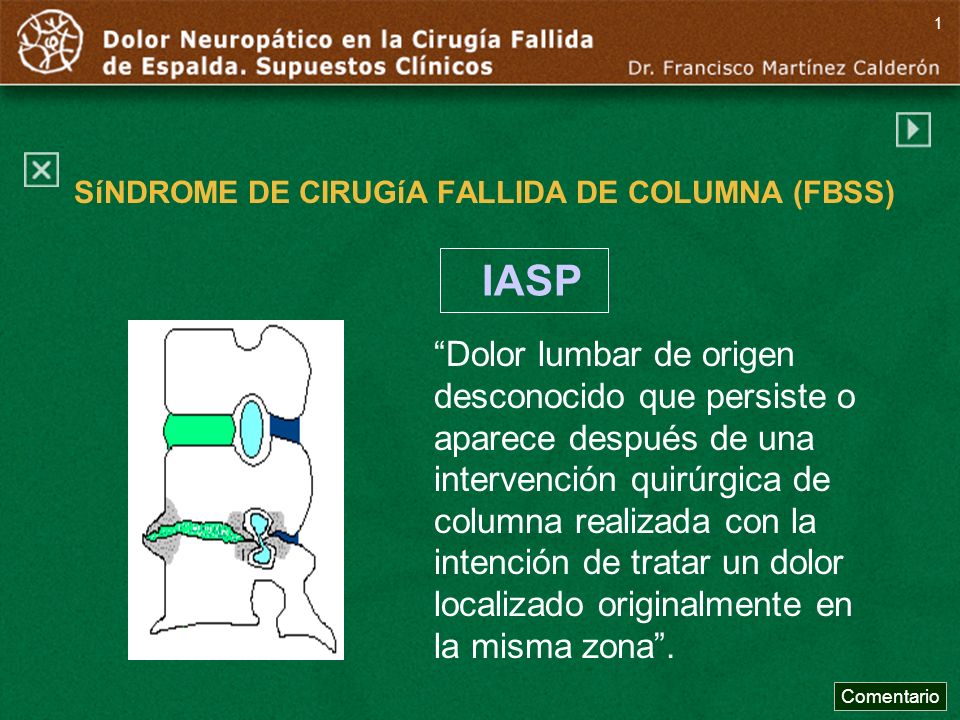 SíNDROME DE CIRUGíA FALLIDA DE COLUMNA (FBSS)