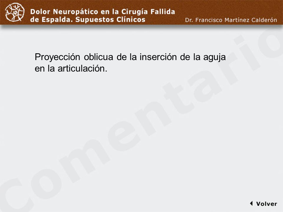 Comentario a diapo22 Proyección oblicua de la inserción de la aguja en la articulación.
