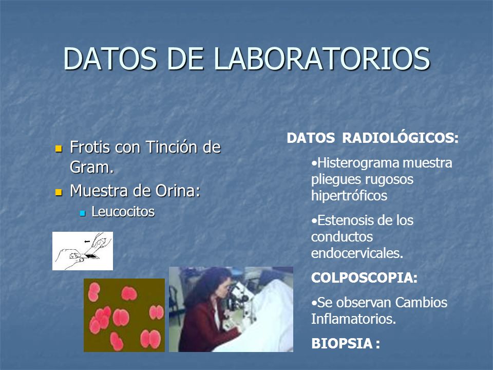 DATOS DE LABORATORIOS Frotis con Tinción de Gram. Muestra de Orina: