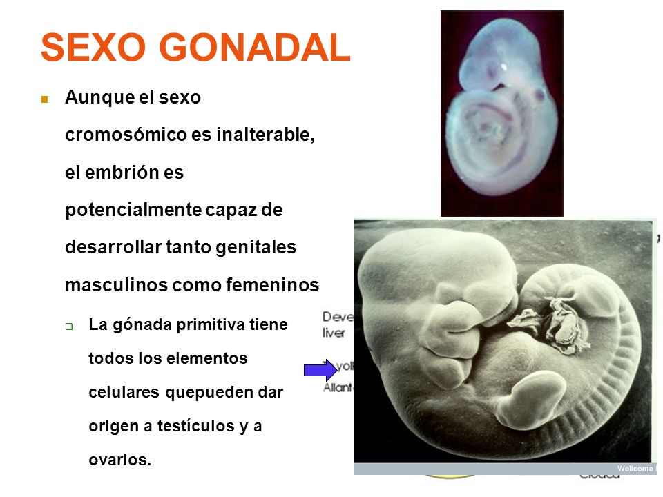 SEXO GONADAL Aunque el sexo cromosómico es inalterable, el embrión es potencialmente capaz de desarrollar tanto genitales masculinos como femeninos.