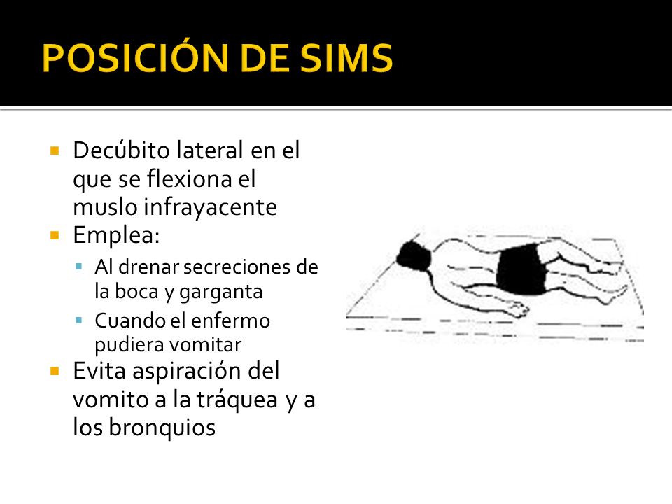 POSICIÓN DE SIMS Decúbito lateral en el que se flexiona el muslo infrayacente. Emplea: Al drenar secreciones de la boca y garganta.