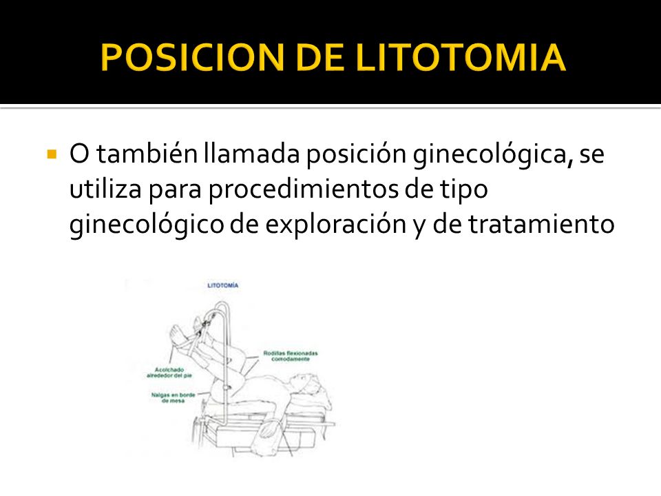 POSICION DE LITOTOMIA O también llamada posición ginecológica, se utiliza para procedimientos de tipo ginecológico de exploración y de tratamiento.