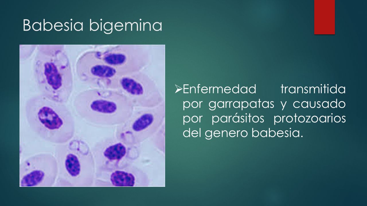 Babesia bigemina Enfermedad transmitida por garrapatas y causado por parásitos protozoarios del genero babesia.