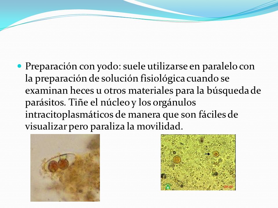 Preparación con yodo: suele utilizarse en paralelo con la preparación de solución fisiológica cuando se examinan heces u otros materiales para la búsqueda de parásitos.