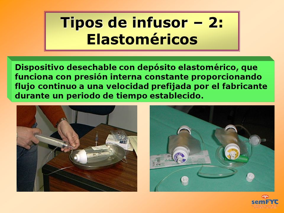 Tipos de infusor – 2: Elastoméricos