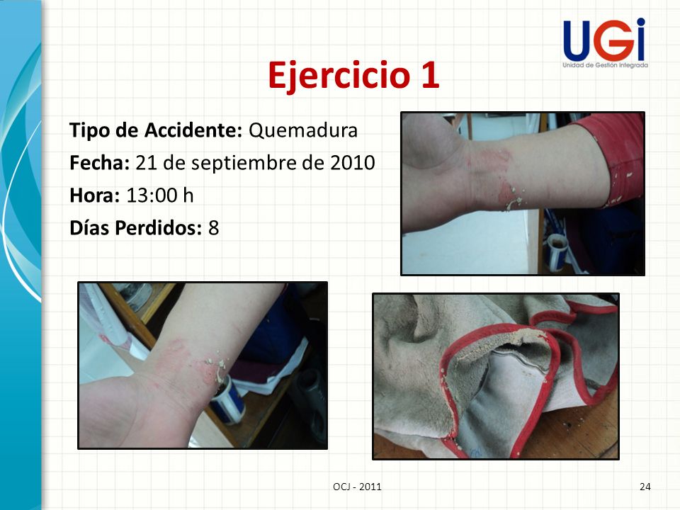 Ejercicio 1 Tipo de Accidente: Quemadura Fecha: 21 de septiembre de 2010 Hora: 13:00 h Días Perdidos: 8