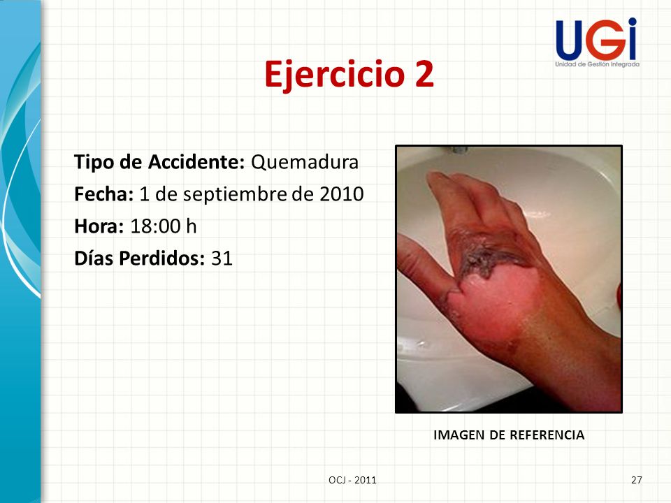 Ejercicio 2 Tipo de Accidente: Quemadura Fecha: 1 de septiembre de 2010 Hora: 18:00 h Días Perdidos: 31