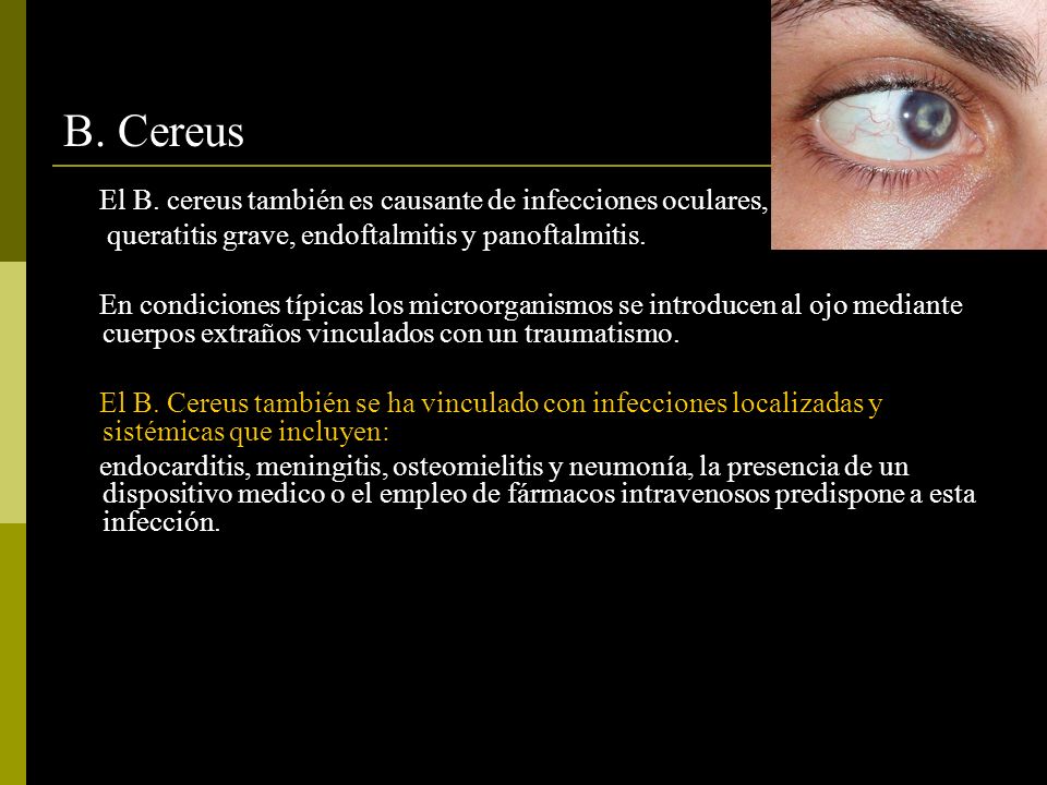B. Cereus El B. cereus también es causante de infecciones oculares,