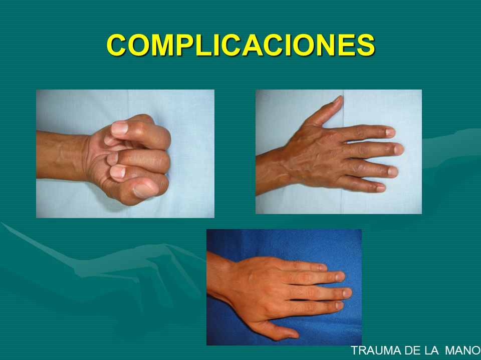 COMPLICACIONES TRAUMA DE LA MANO