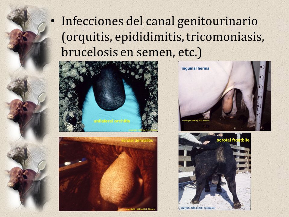 Infecciones del canal genitourinario (orquitis, epididimitis, tricomoniasis, brucelosis en semen, etc.)