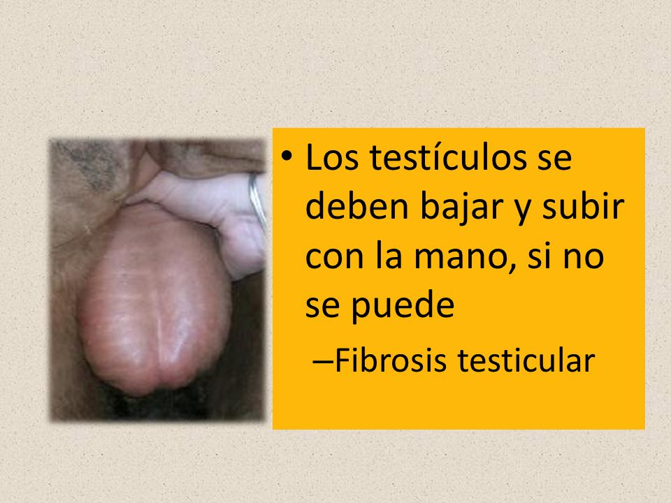 Los testículos se deben bajar y subir con la mano, si no se puede