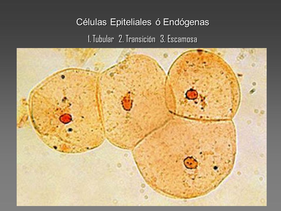 Células Epiteliales ó Endógenas 1. Tubular 2. Transición 3. Escamosa