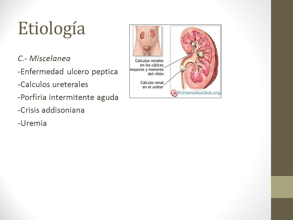 Etiología C.- Miscelanea -Enfermedad ulcero peptica -Calculos ureterales -Porfiria intermitente aguda -Crisis addisoniana -Uremia