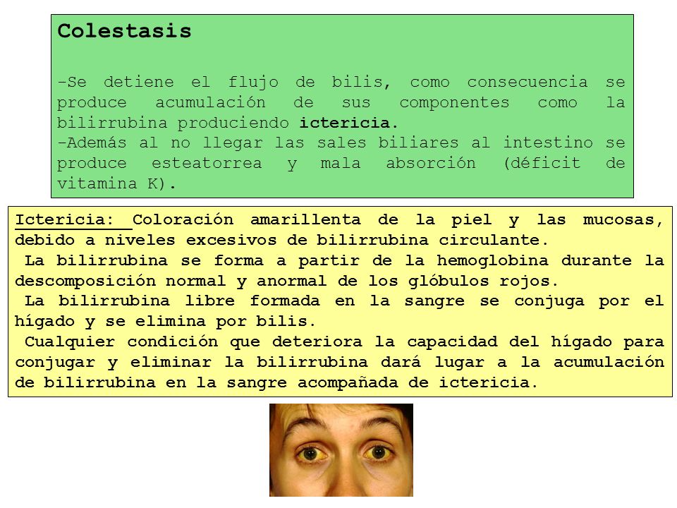 Colestasis Se detiene el flujo de bilis, como consecuencia se produce acumulación de sus componentes como la bilirrubina produciendo ictericia.
