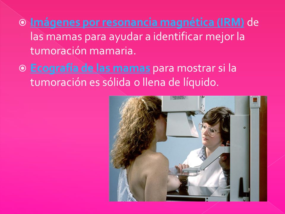 Imágenes por resonancia magnética (IRM) de las mamas para ayudar a identificar mejor la tumoración mamaria.