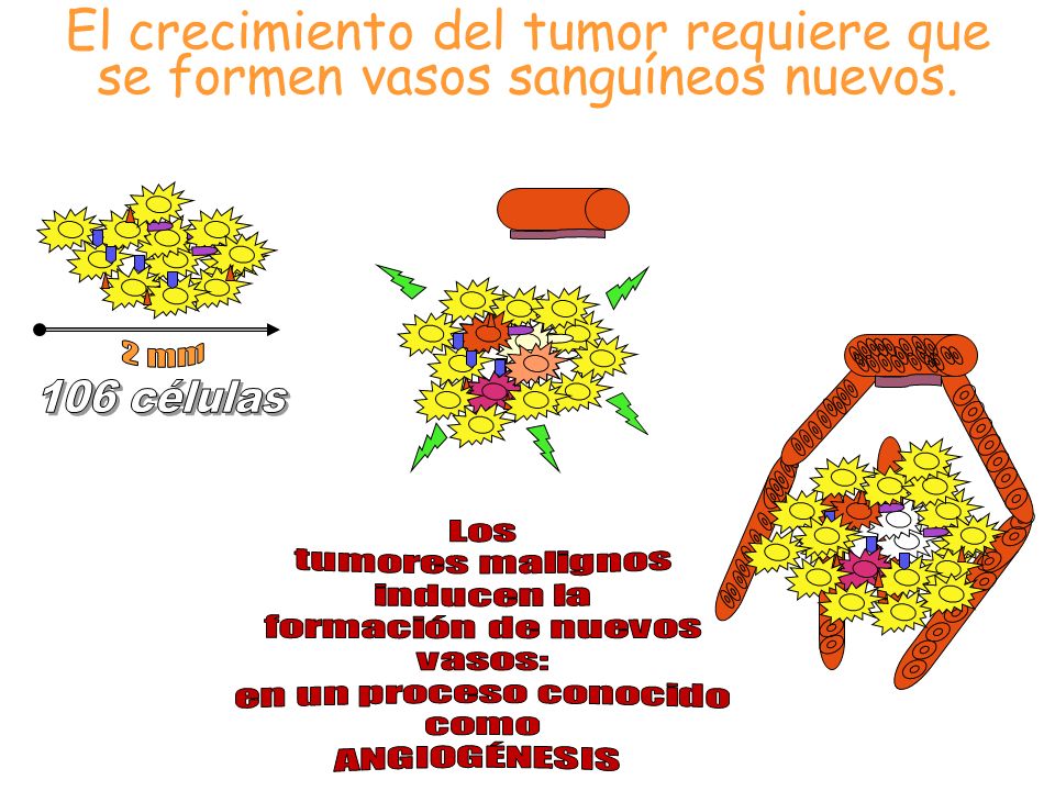 El crecimiento del tumor requiere que se formen vasos sanguíneos nuevos.