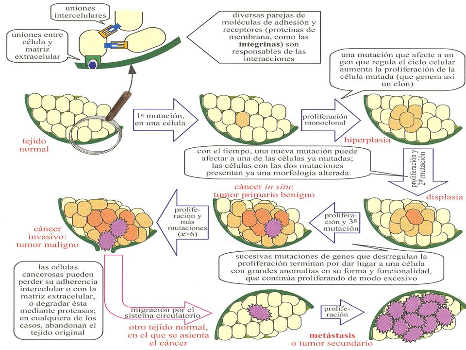 Etapas características en el desarrollo del cáncer: Tumor benigno