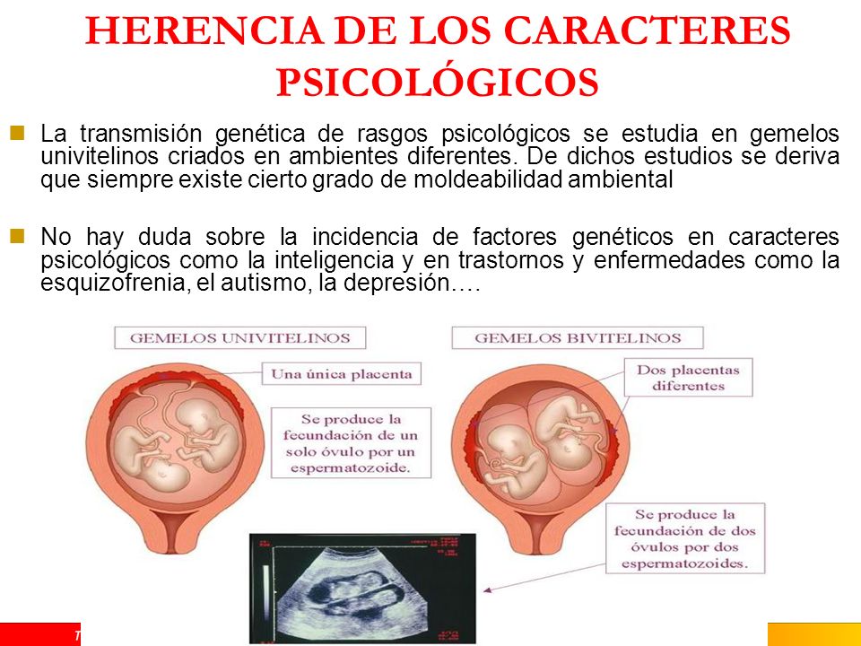 ALTERACIONES EN LOS CARIOTIPOS Síndrome de Down