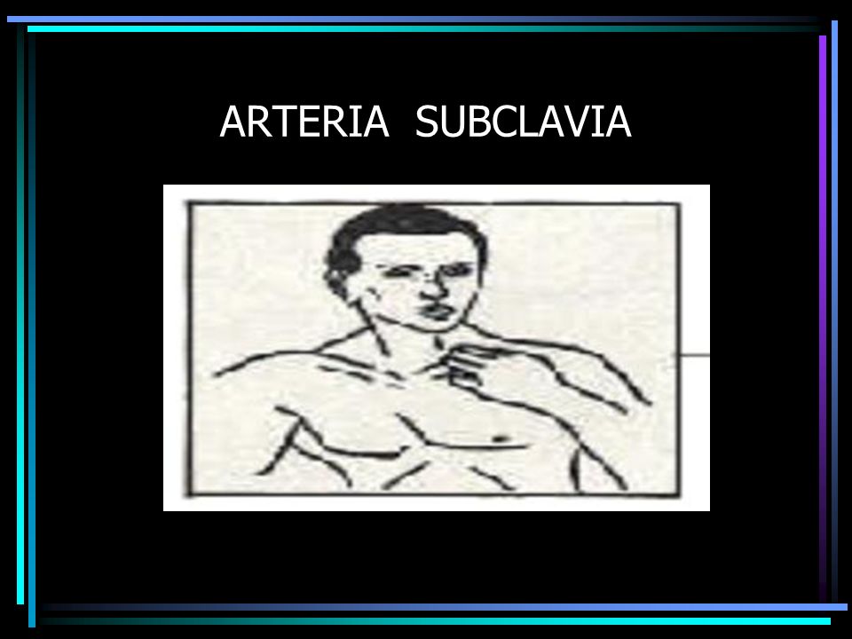ARTERIA SUBCLAVIA