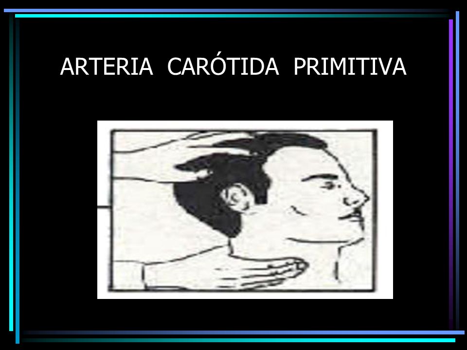 ARTERIA CARÓTIDA PRIMITIVA