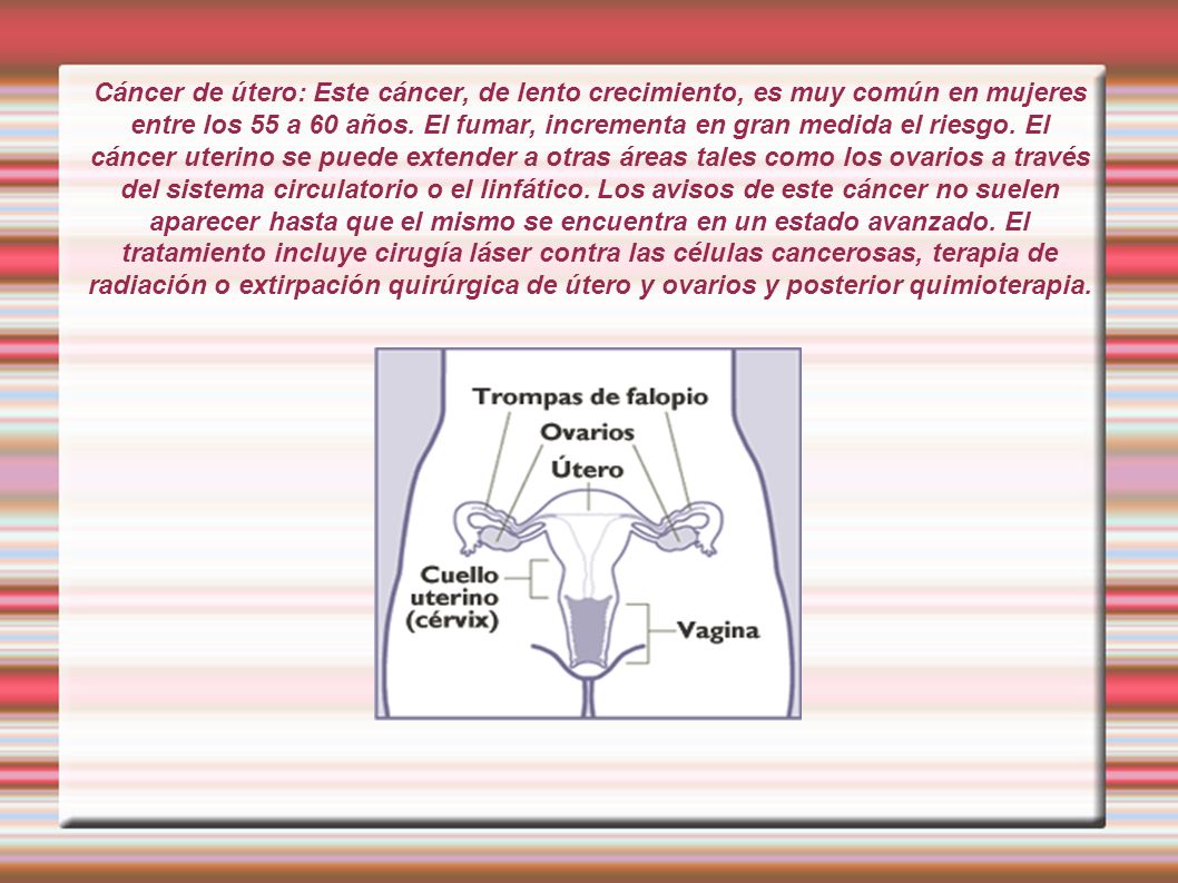Cáncer de útero: Este cáncer, de lento crecimiento, es muy común en mujeres entre los 55 a 60 años.