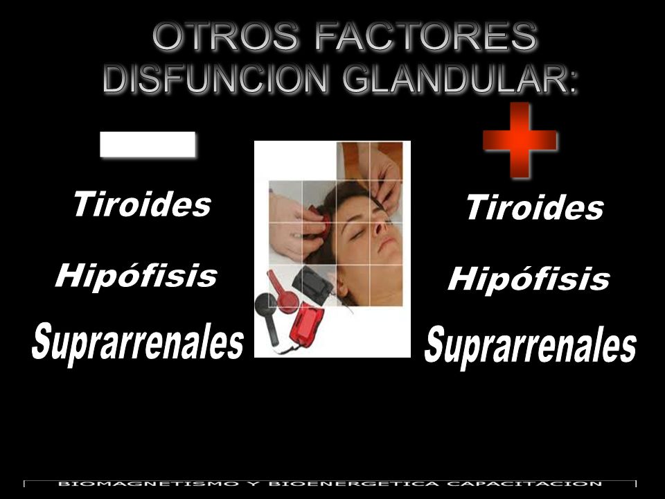 OTROS FACTORES DISFUNCION GLANDULAR: + - Tiroides. Tiroides. Hipófisis. Hipófisis. Suprarrenales.