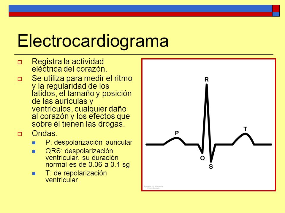 Electrocardiograma Registra la actividad eléctrica del corazón.