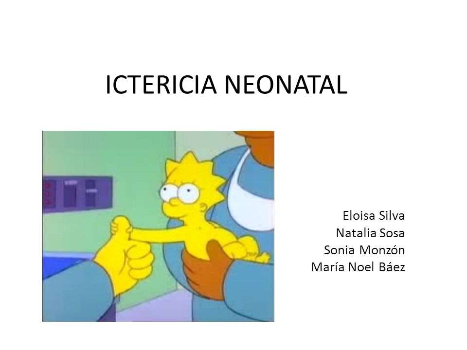 ICTERICIA NEONATAL Eloisa Silva Natalia Sosa Sonia Monzón