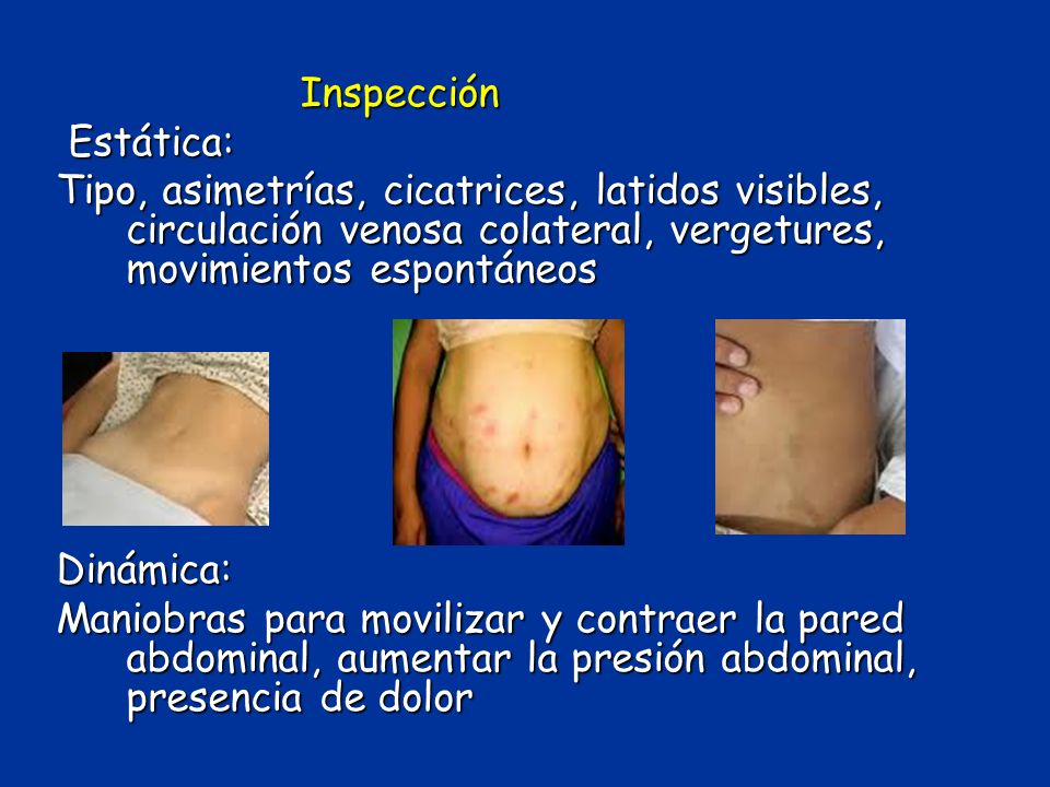 Inspección Estática: Tipo, asimetrías, cicatrices, latidos visibles, circulación venosa colateral, vergetures, movimientos espontáneos.