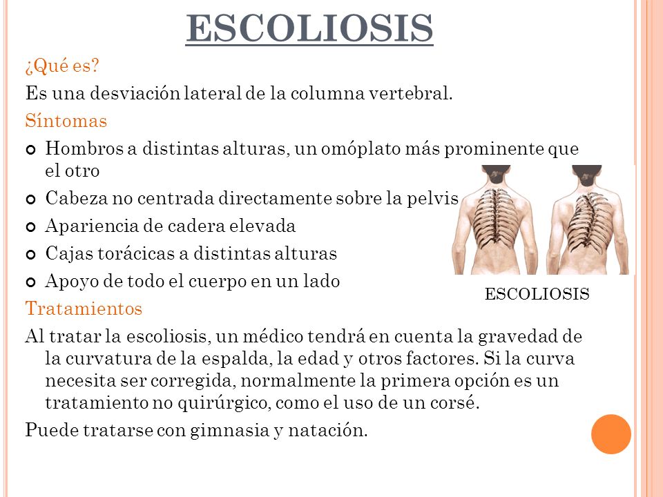 ESCOLIOSIS ¿Qué es Es una desviación lateral de la columna vertebral.