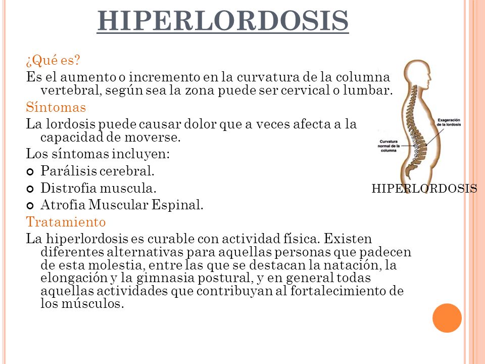 HIPERLORDOSIS ¿Qué es Es el aumento o incremento en la curvatura de la columna vertebral, según sea la zona puede ser cervical o lumbar.