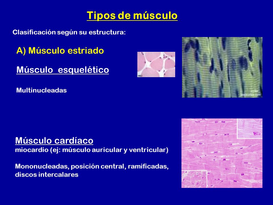 Tipos de músculo A) Músculo estriado Músculo esquelético
