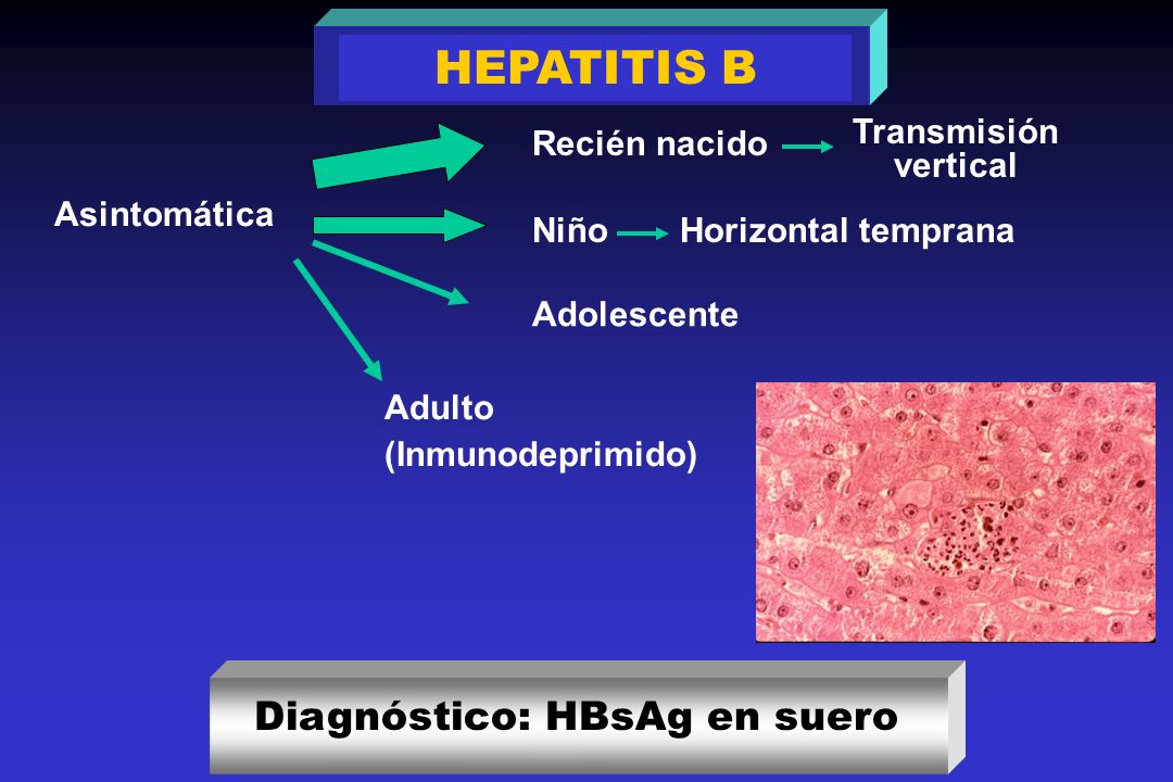 HEPATITIS B Diagnóstico: HBsAg en suero Asintomática Recién nacido