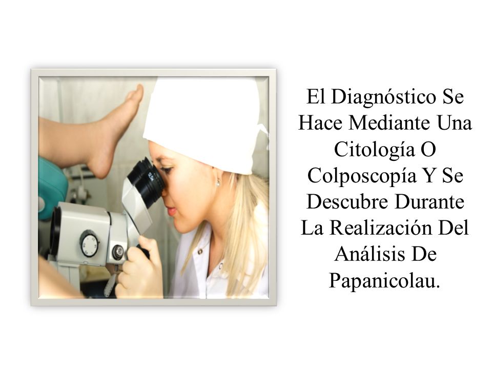El Diagnóstico Se Hace Mediante Una Citología O Colposcopía Y Se Descubre Durante La Realización Del Análisis De Papanicolau.