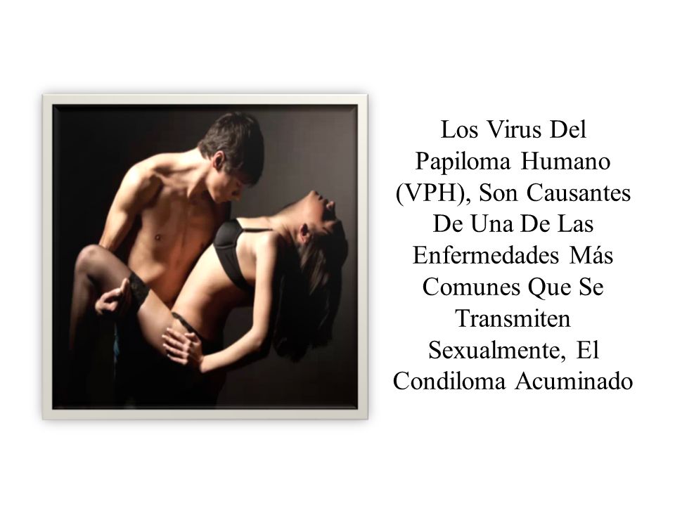 Los Virus Del Papiloma Humano (VPH), Son Causantes De Una De Las Enfermedades Más Comunes Que Se Transmiten Sexualmente, El Condiloma Acuminado