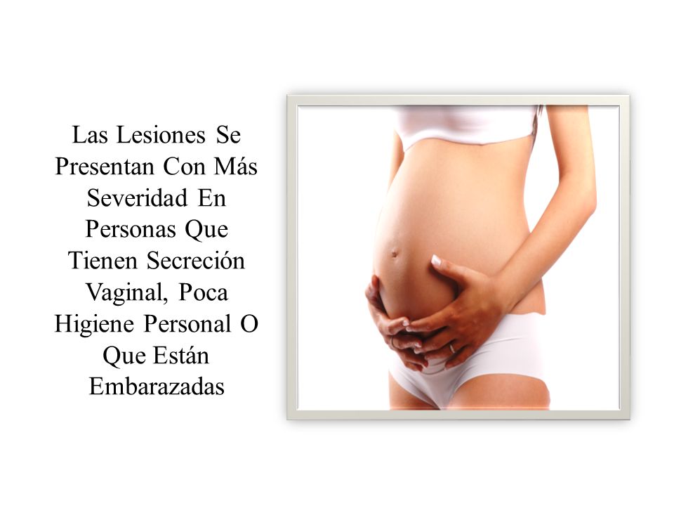 Las Lesiones Se Presentan Con Más Severidad En Personas Que Tienen Secreción Vaginal, Poca Higiene Personal O Que Están Embarazadas