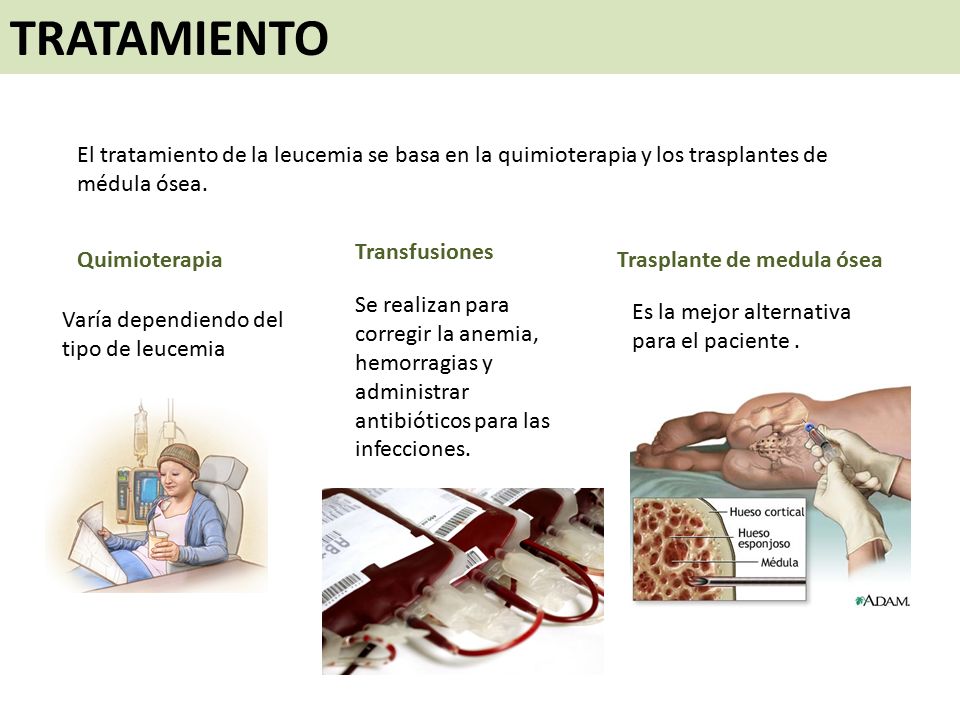 TRATAMIENTO El tratamiento de la leucemia se basa en la quimioterapia y los trasplantes de médula ósea.
