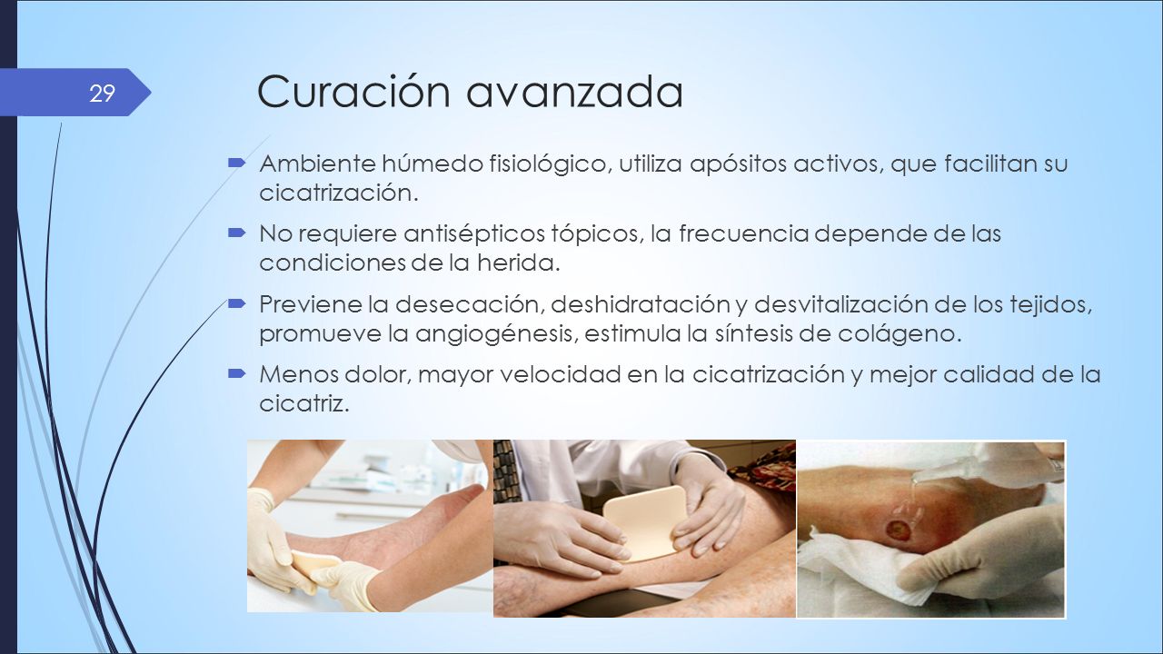 Curación avanzada Ambiente húmedo fisiológico, utiliza apósitos activos, que facilitan su cicatrización.