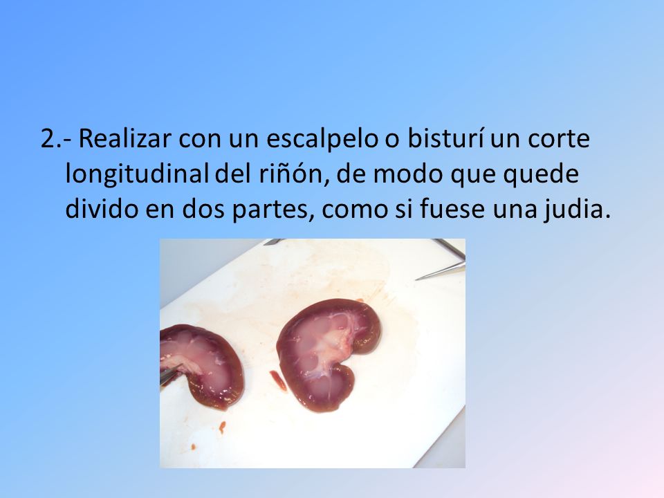 2.- Realizar con un escalpelo o bisturí un corte longitudinal del riñón, de modo que quede divido en dos partes, como si fuese una judia.
