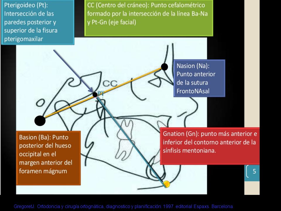 GregoretJ. Ortodoncia y cirugía ortognática, diagnostico y planificación.