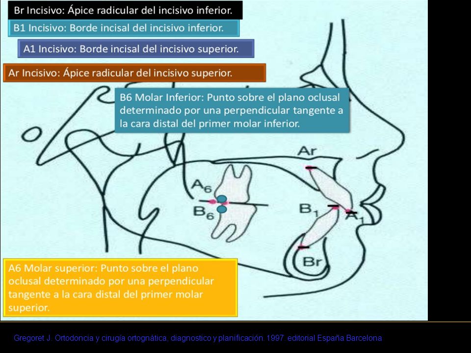 Gregoret J. Ortodoncia y cirugía ortognática, diagnostico y planificación.
